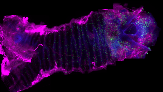 This image of a mouse trachea and larynx on a black background reveals a constelletion of small green dots scattered througout it. The green dots are neuroendocrine cells. Areas around the edges of the image that appear pink are part of the nervous system.